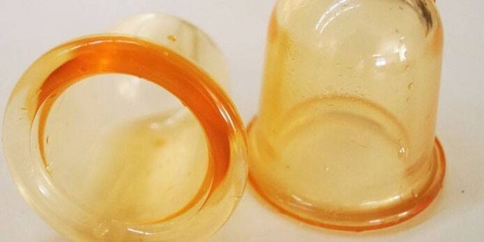 tasses pour le traitement de la prostatite